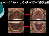 矯正・ホワイトニング・オールセラミック